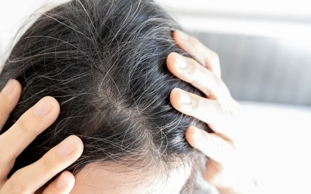 How to Cover Grey Hair Without Compromising Hair Health
