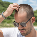 hair loss in summer men
